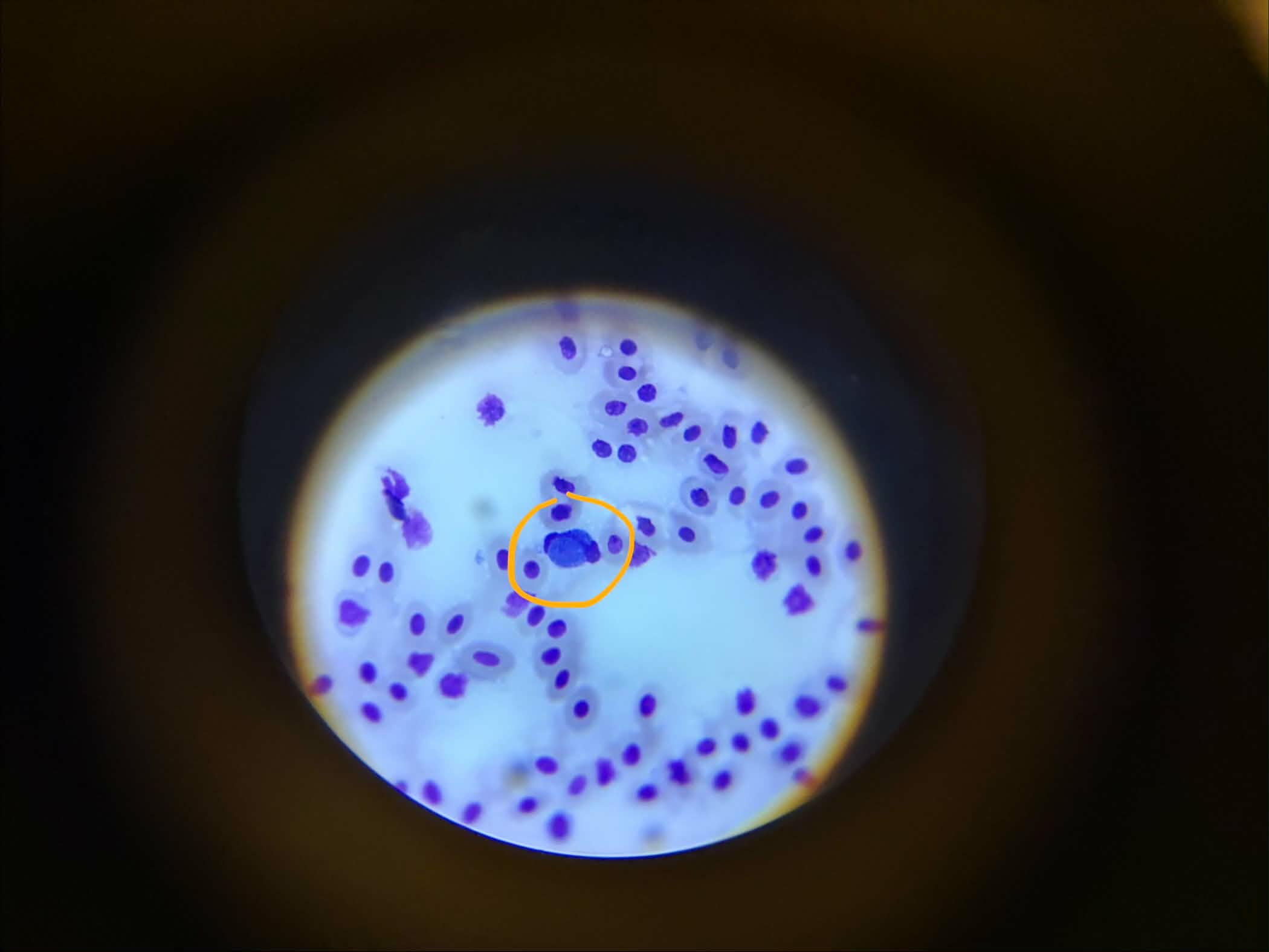 Diagnostisk blodprøvebilde for Leucocytozoon i en fugl