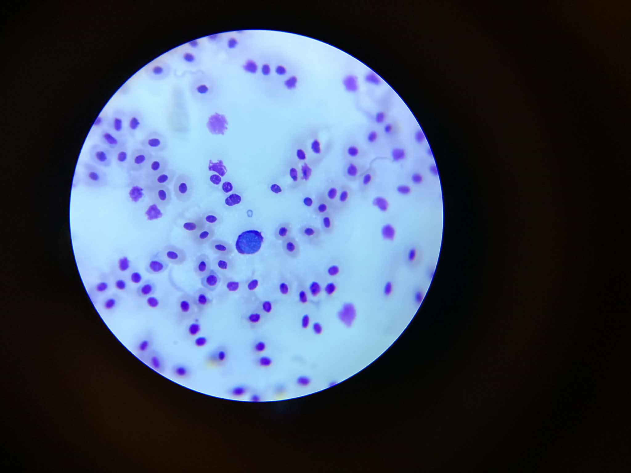 Andre diagnostiske blodprøvebilde for Leucocytozoon i en fugl